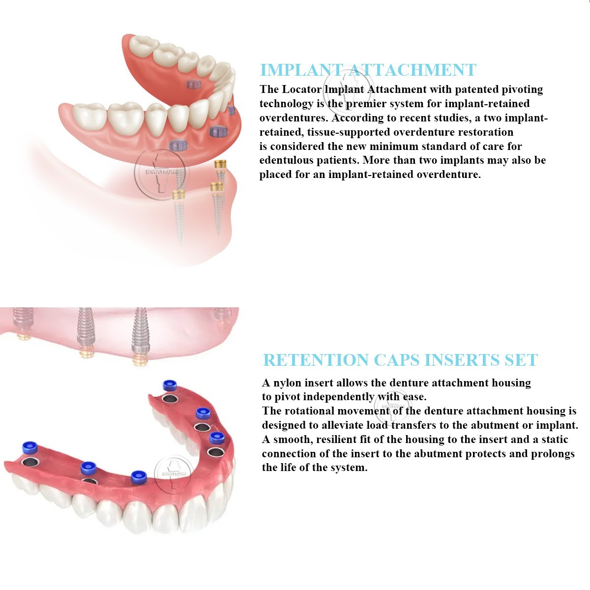 Locator abutment full set male caps fit to DENTIN D3.75 GH0.5-7.5mm