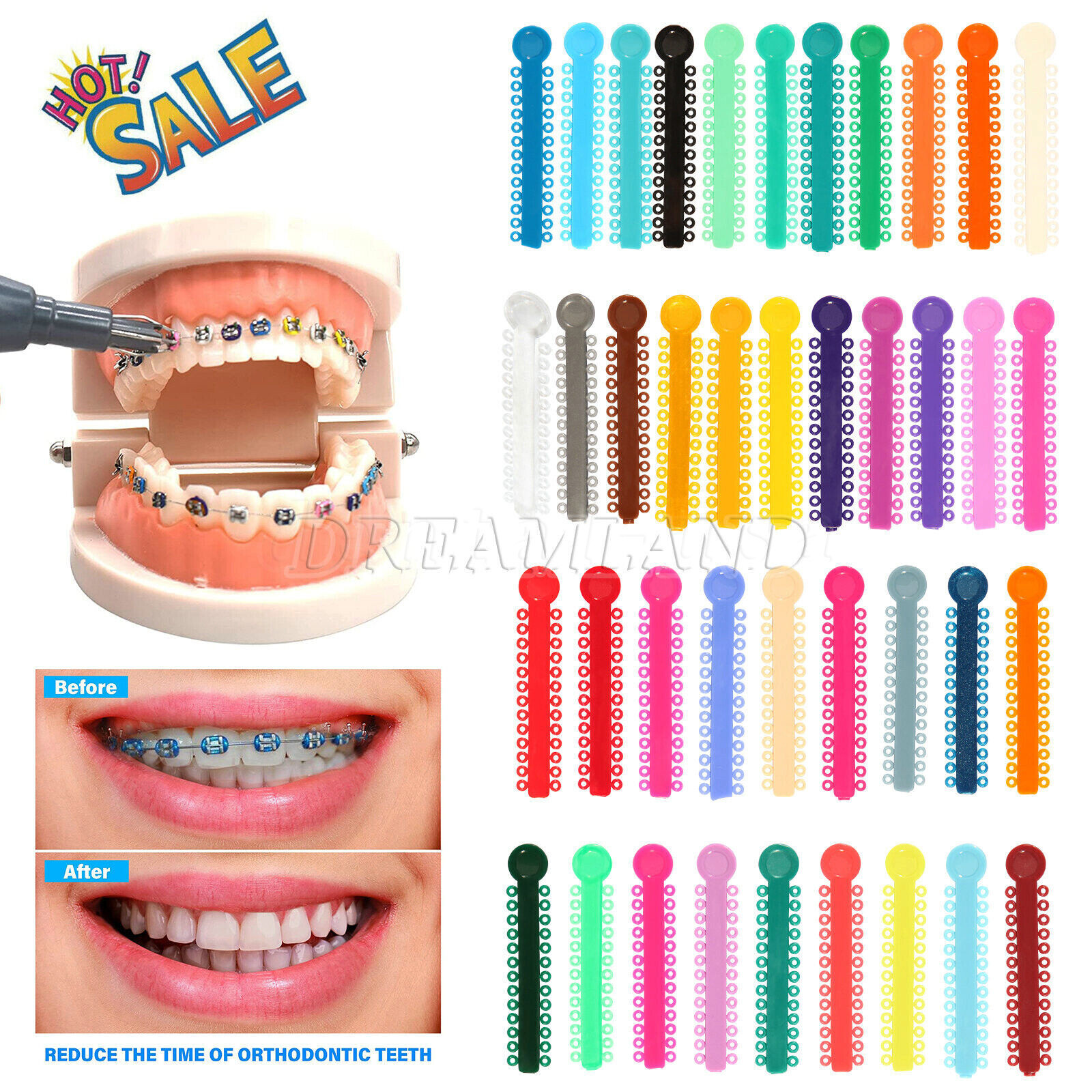 1 Pack Dental Orthodontics Elastic 1040 Pcs Ligature Ties For Choose 44 Colors