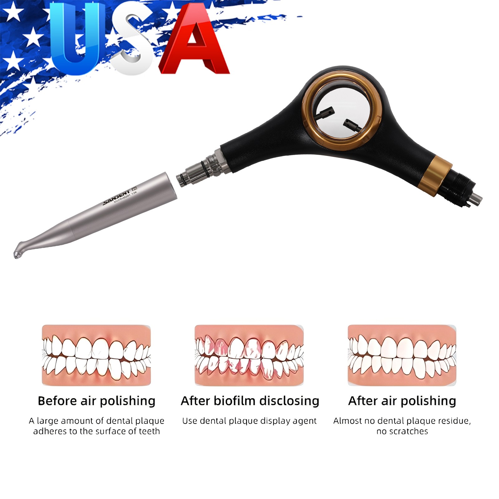 SANDENT Dental Air Flow Prophy Air Polisher Supra Handpiece 4 Holes