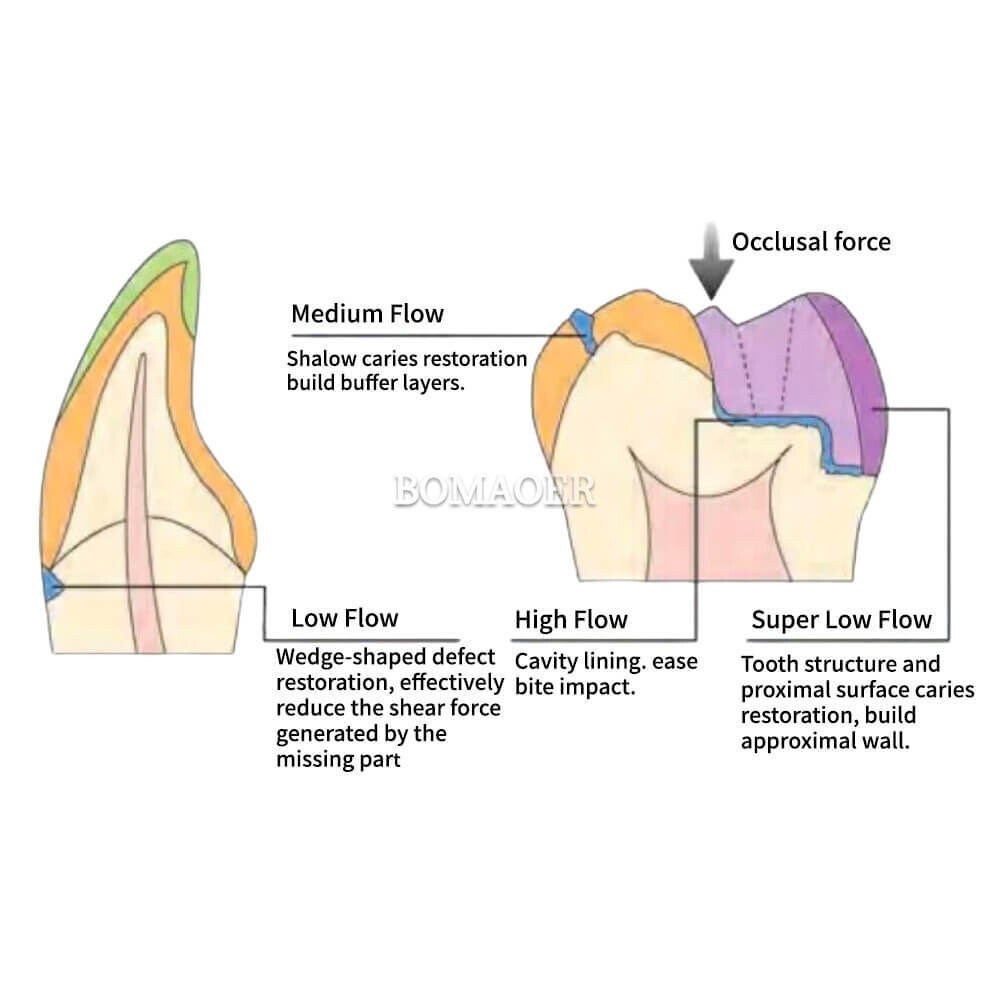 Dental Light curing Composite Flowable Resins Super Low Flow 4 shades 3g/Syringe