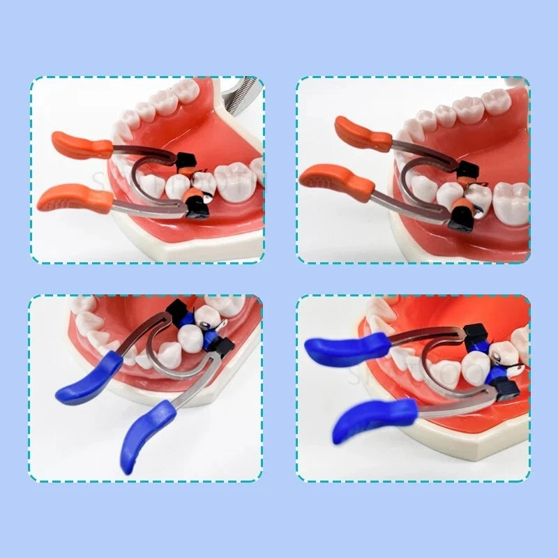 Dental Matrix Ring Titanium Clamp Sectional Matrice Clamp Fit Palodent V3 System