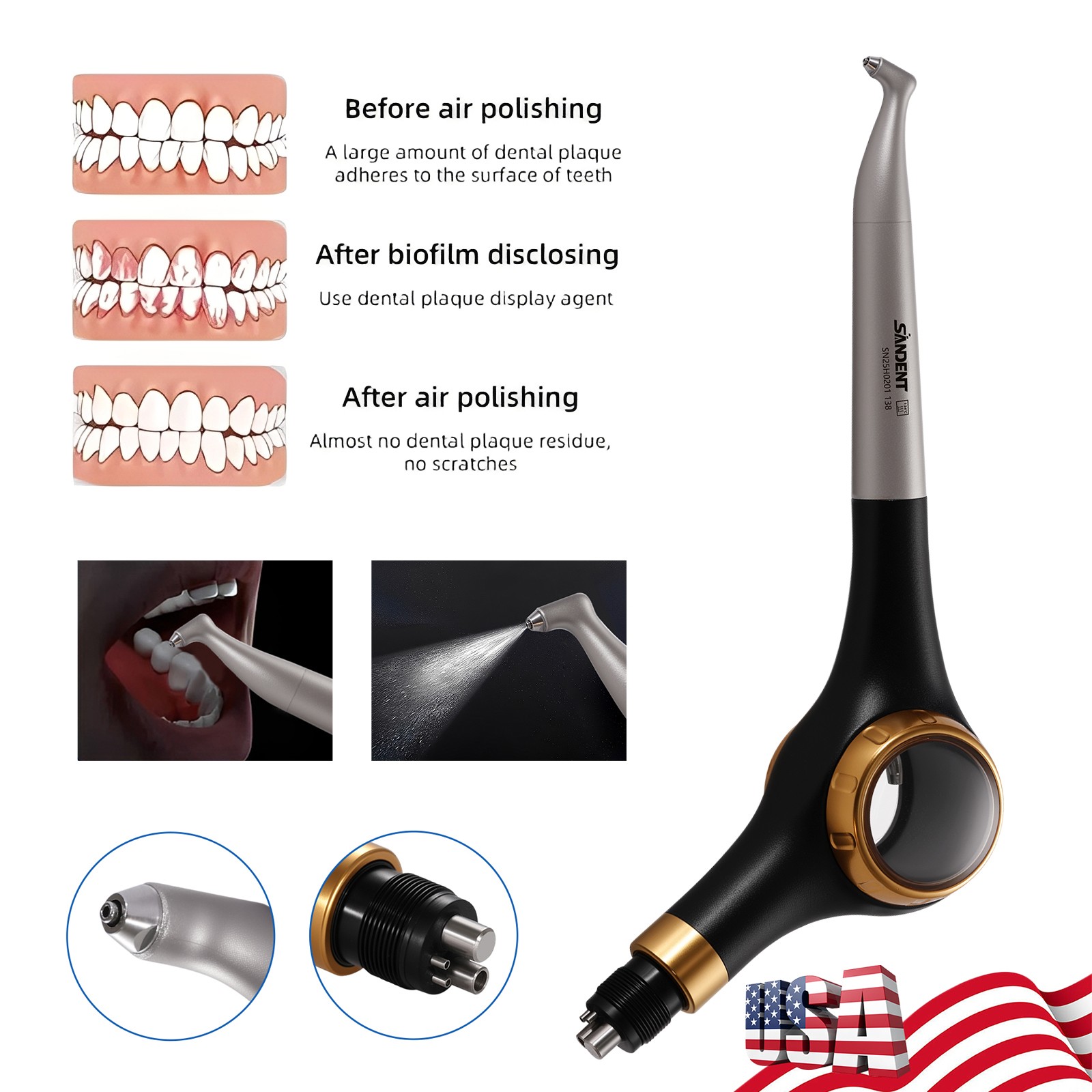 SANDENT Dental Air Flow Prophy Air Polisher Supra Handpiece 4 Holes