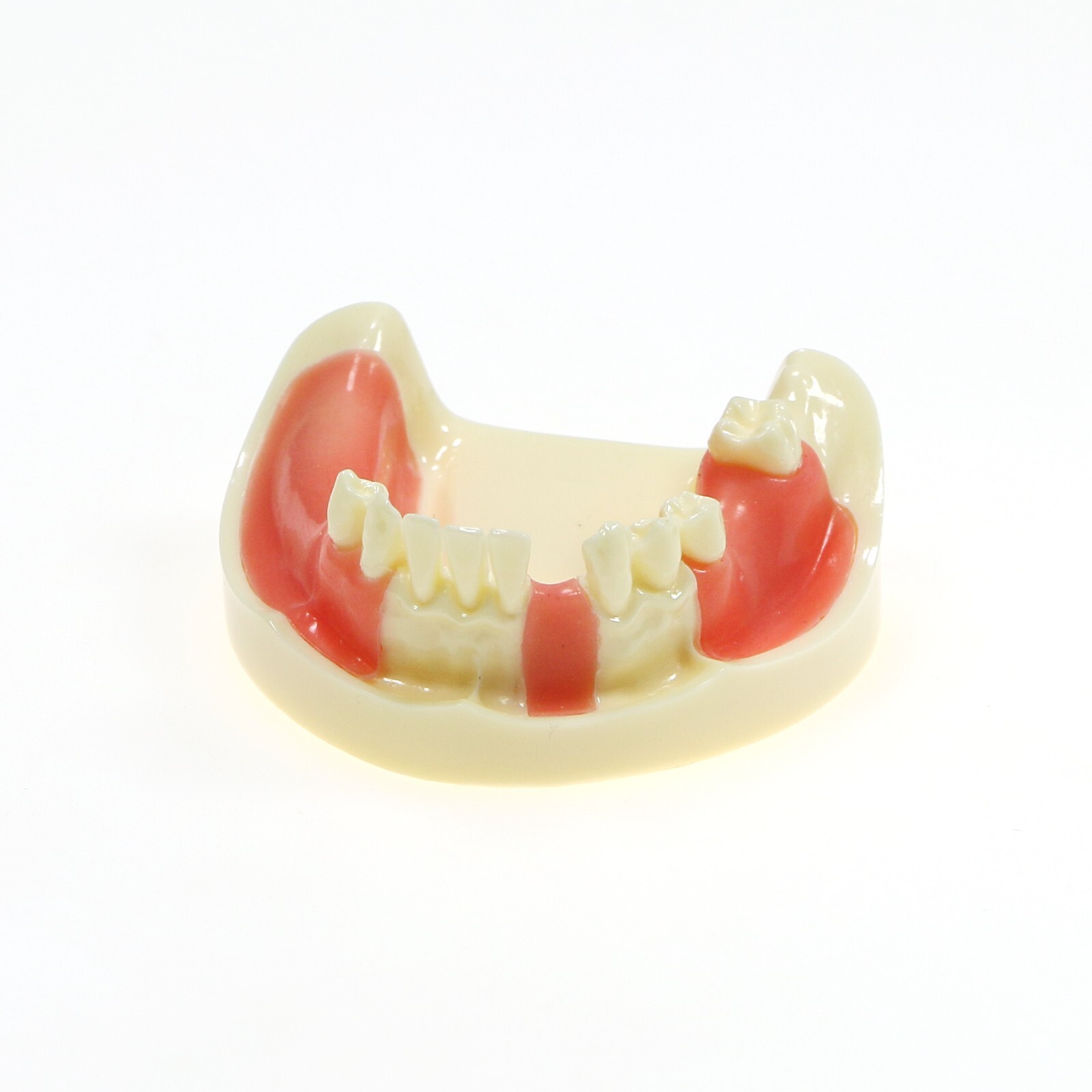 Dental Typodont Teeth Model Overdenture Implant Practice Endo Ortho Teachi Study