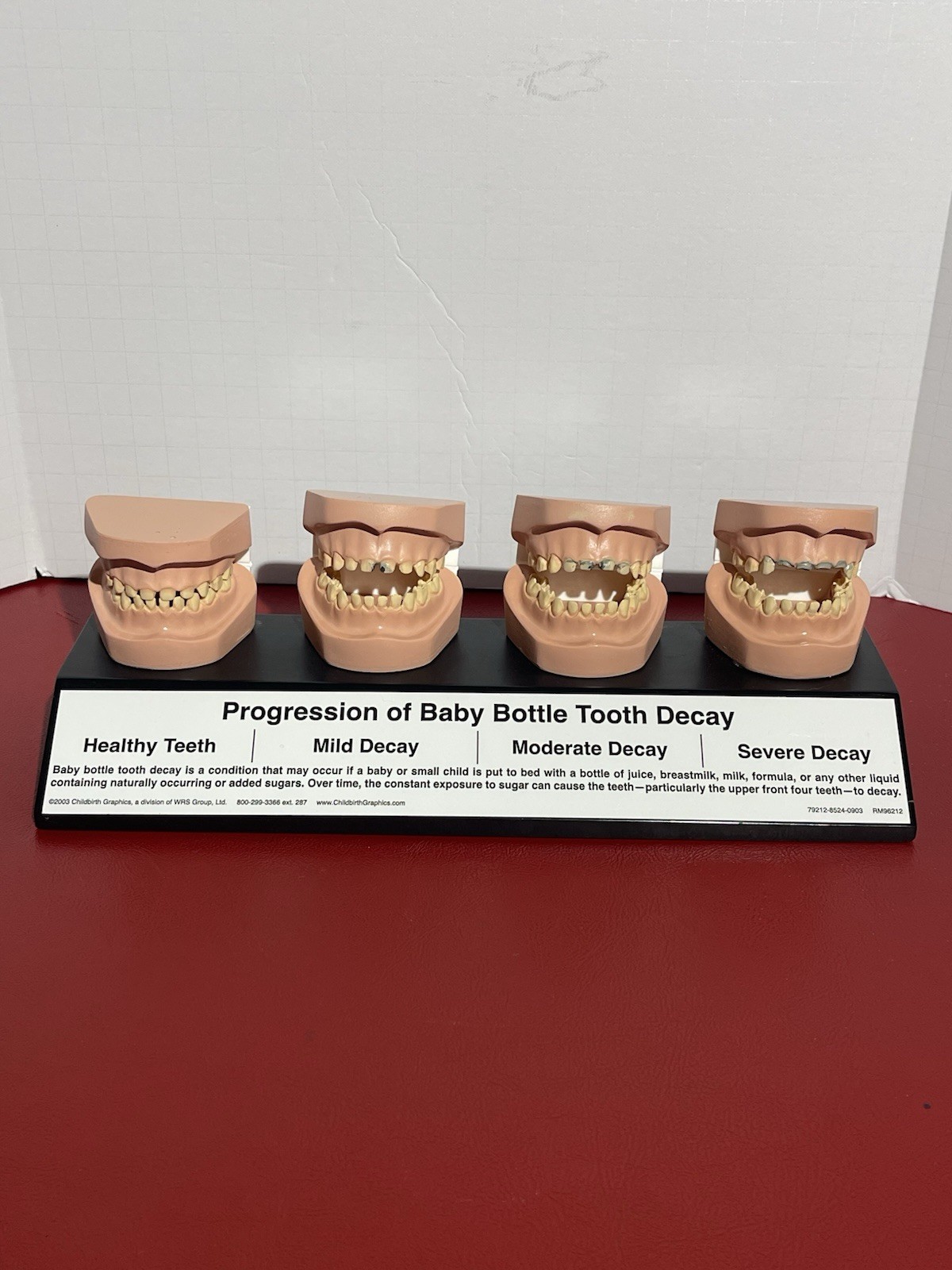 2003 Progression of Baby Bottle Tooth Decay Dental Anatomical Model Anatomy
