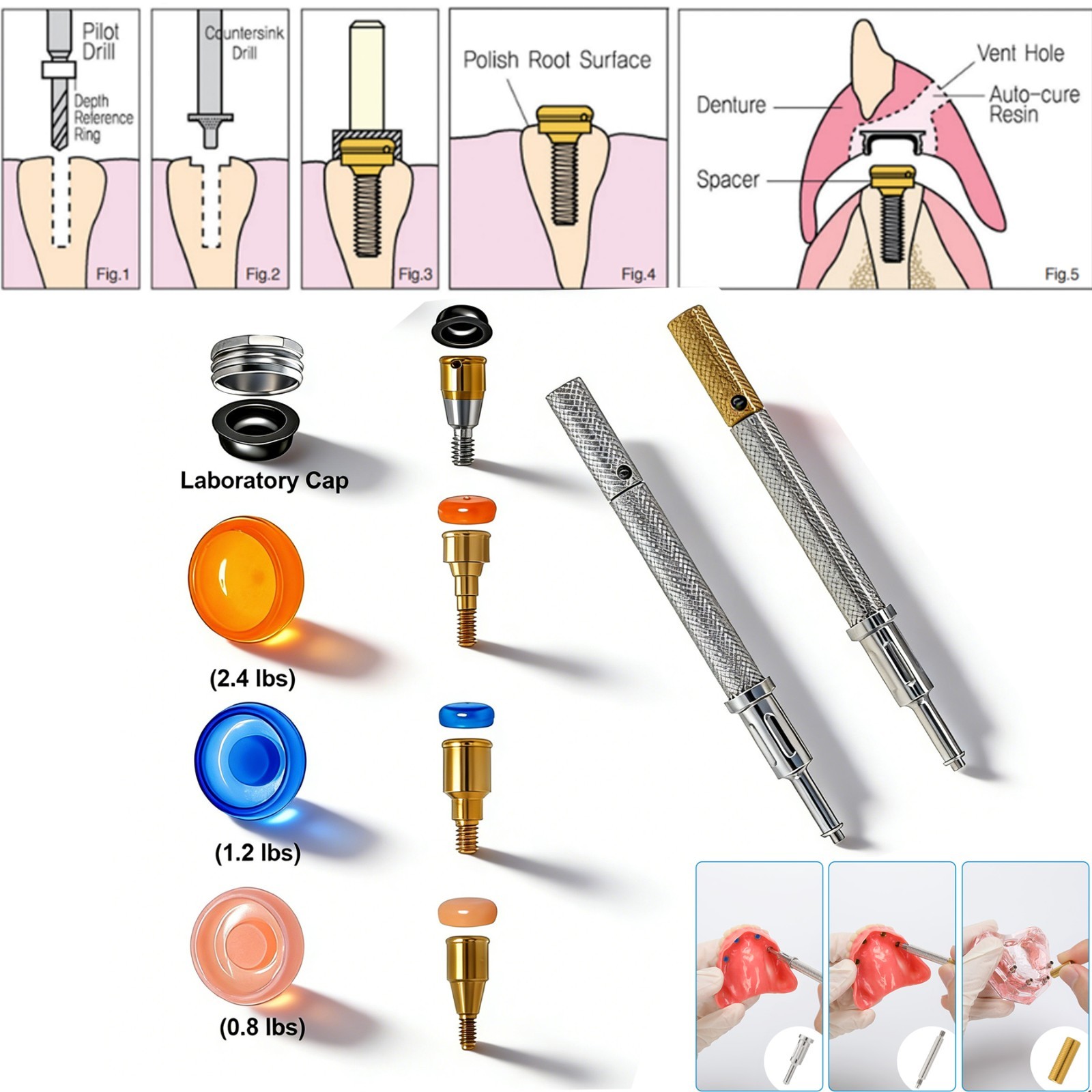 US LOCATOR Abutment Compatible with the ZimVie /Zimmer Biomet Tapered Screw Vent