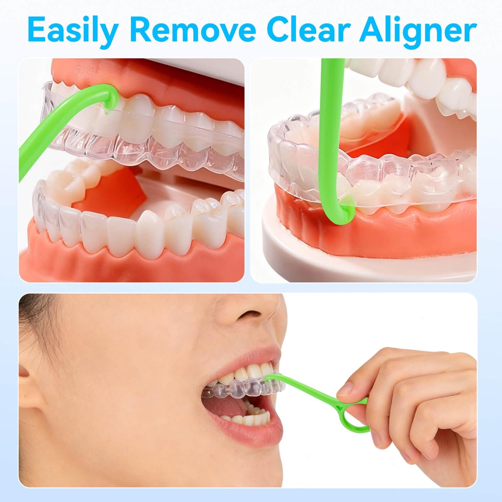 15PCS Clear Aligner Remover Tool for Invisalign, Easy & Gentle Orthodontic Align