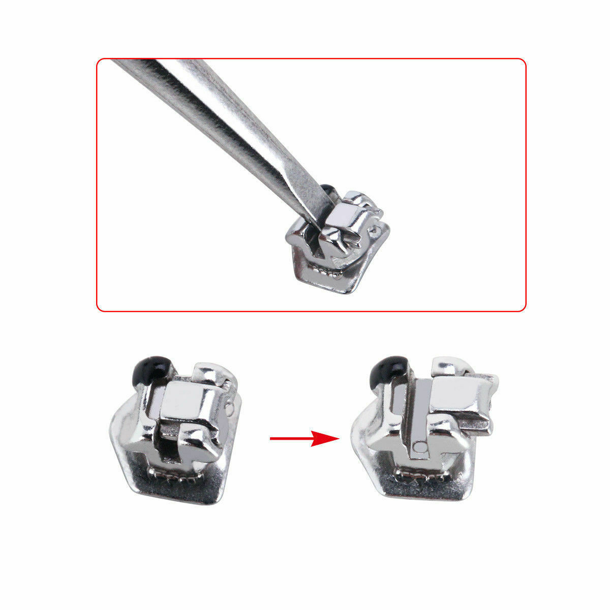 Dental Orthodontic Self Ligating Brackets Braces Roth / MBT 022 Hook 345 AZDENT