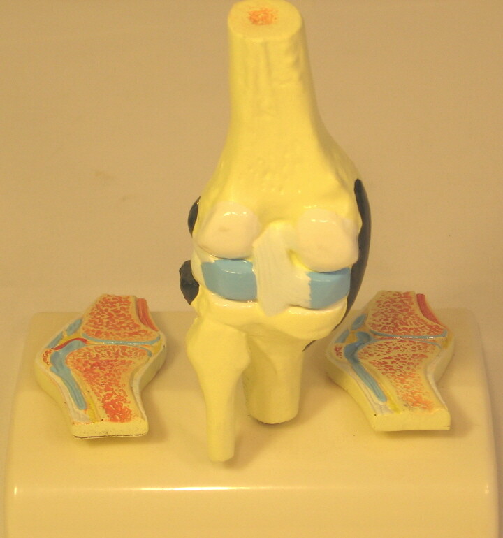 Arthritis bone joint sections anatomical model life-size New