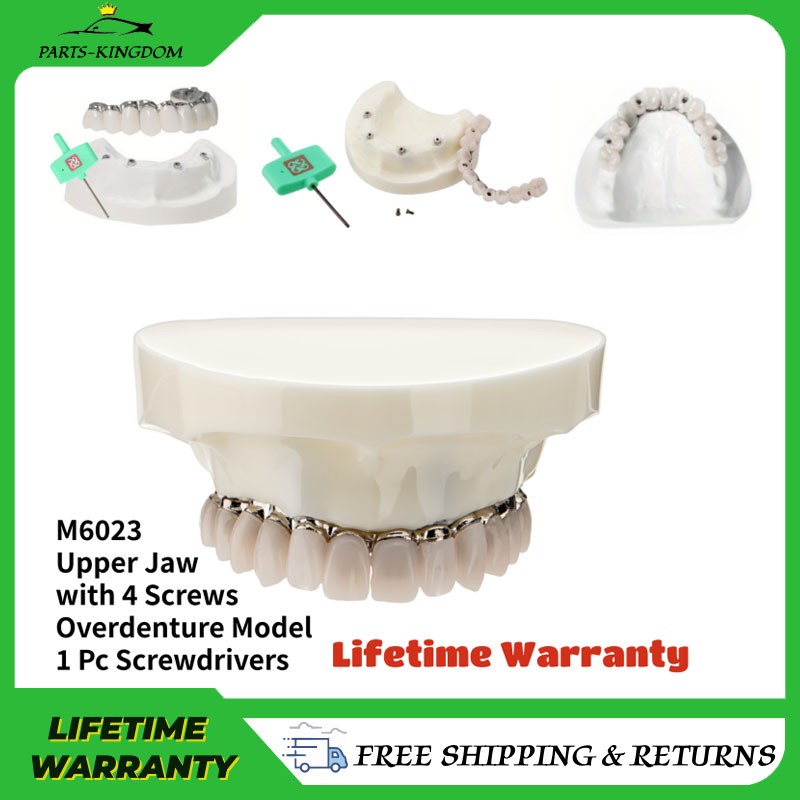 All-on-4 Dental Overdenture Model Dental Upper Jaw Implants Restoration 4 Screws