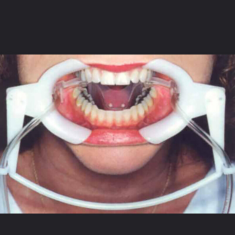 Dental Orthodontic Nola Cheek Retractor Dry Field System Mouth Opener Parts S/L