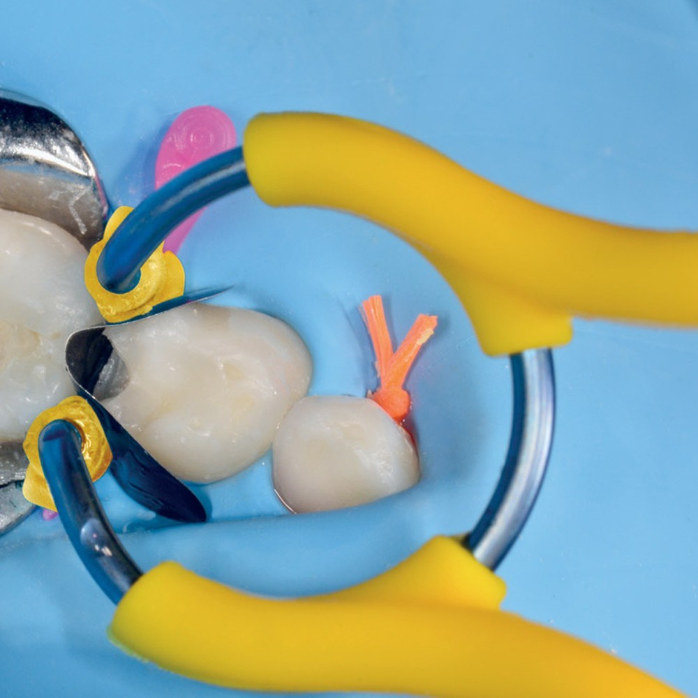 Polydentia myJunior Paediatric Sectional Matrix System Kit