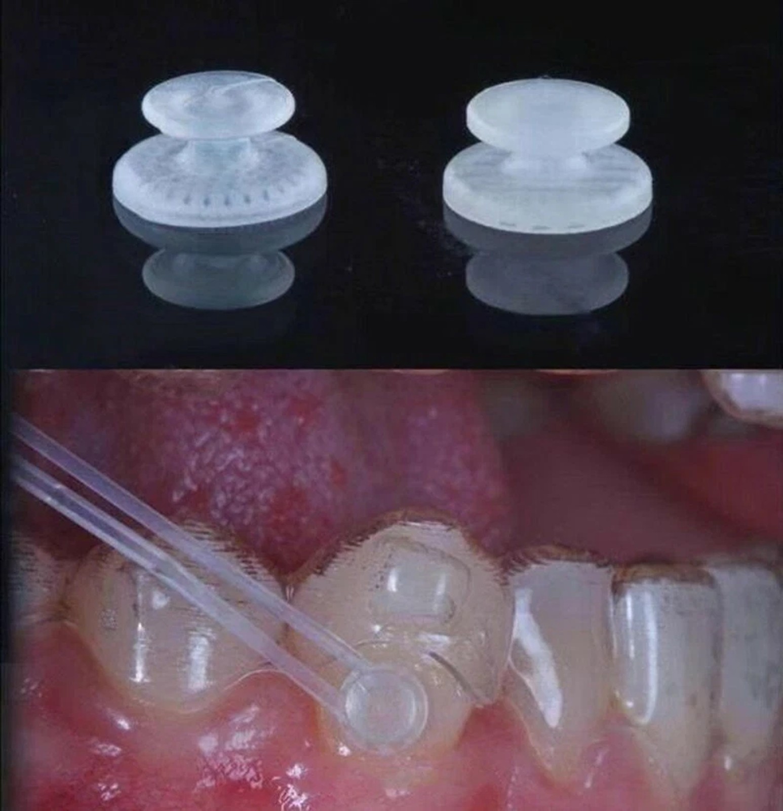Dental Lingual Button Ceramic Clear Invisable Retainer Aligner Bondable Round