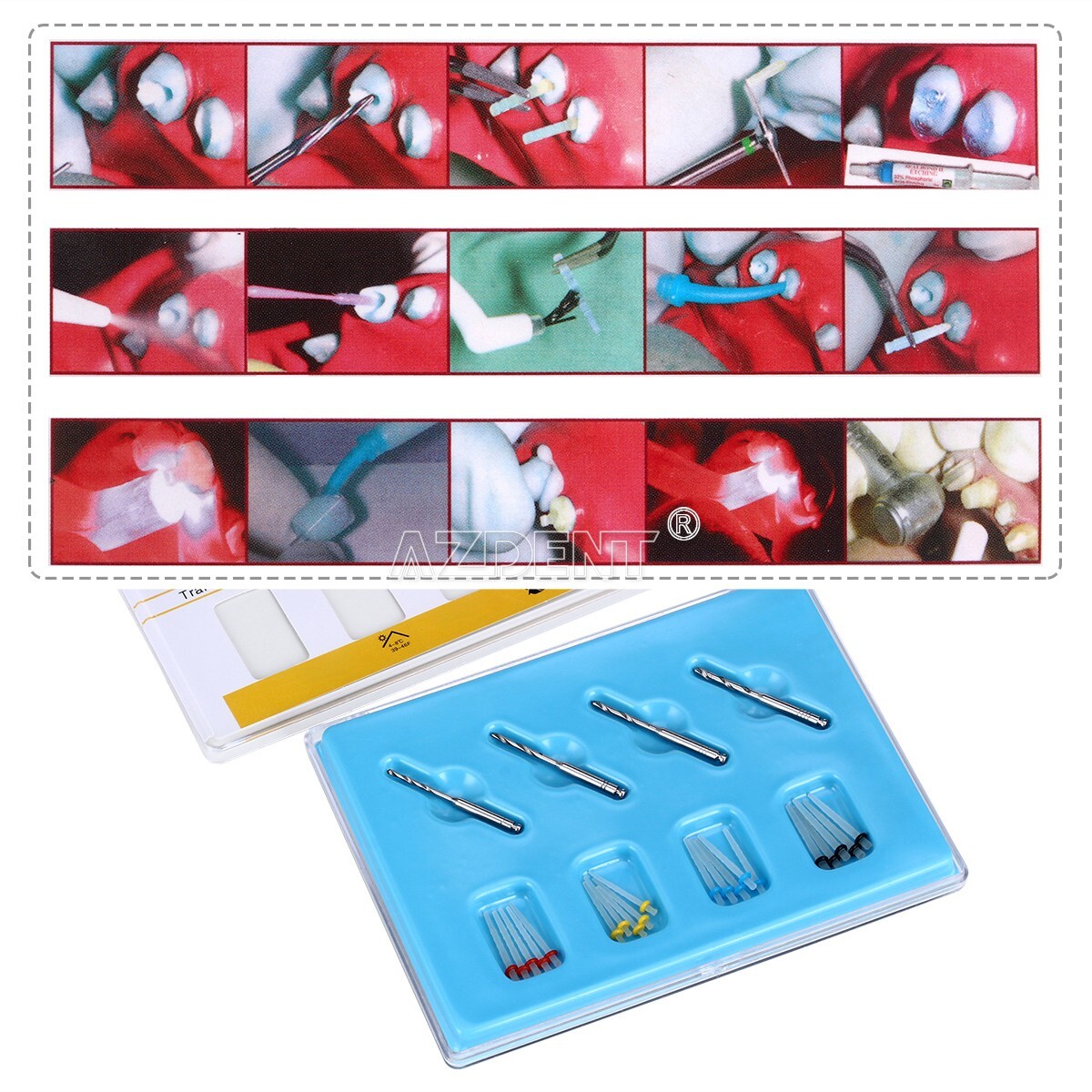 Dental Endodontic AAA Fiber Post Kit 1.2mm 1.4mm 1.6mm 1.8mm +4Pcs Drills