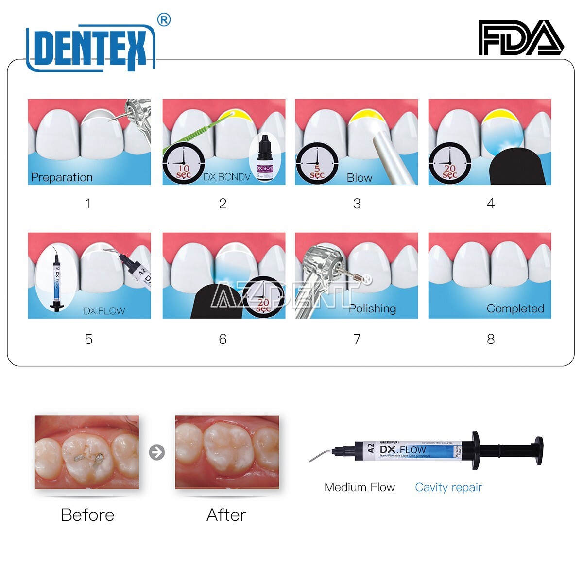DENTEX Dental Flowable Light Cure Composite Resin Medium Flow A2 3g/ Syringe