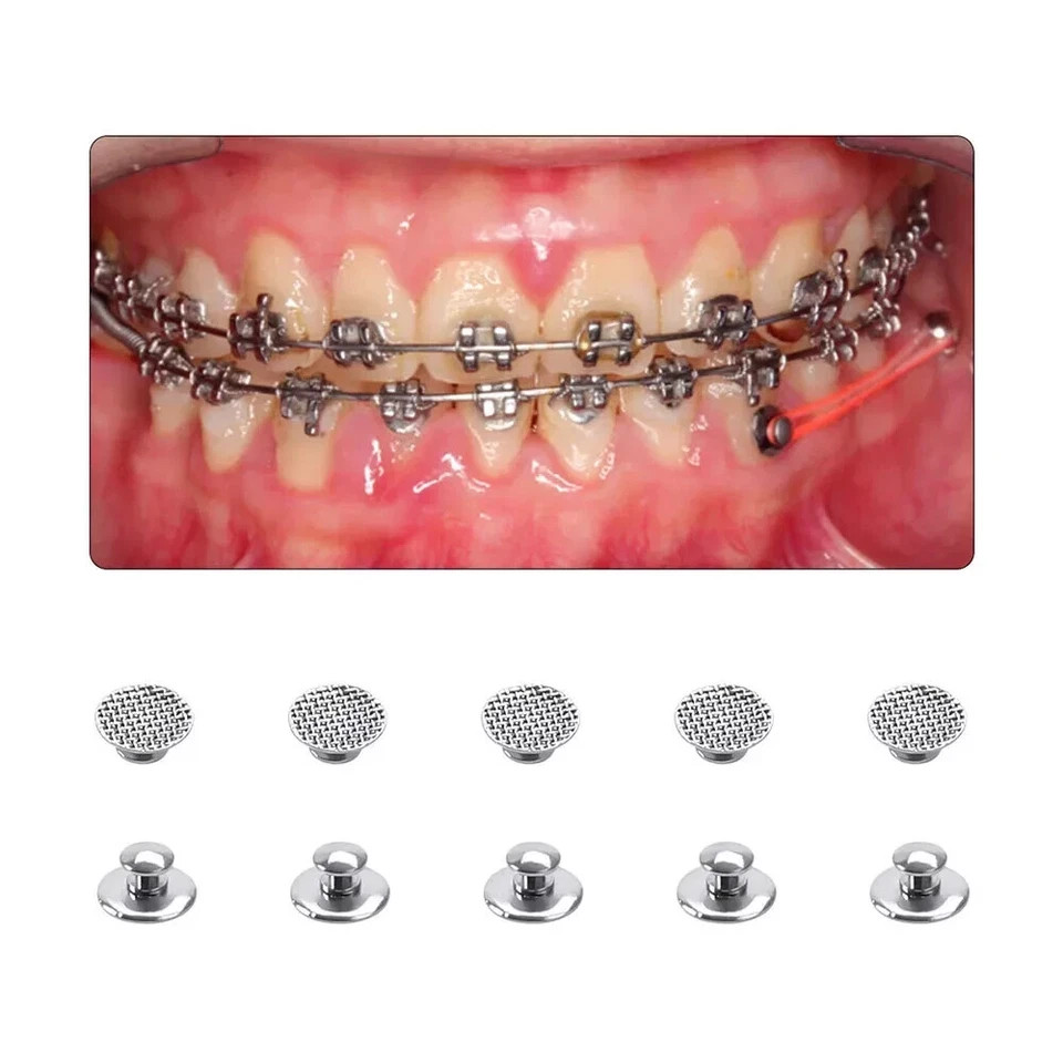 32 Model Dental Orthodontic Bondable Lingual Buttons Round Rectangular Mesh Base