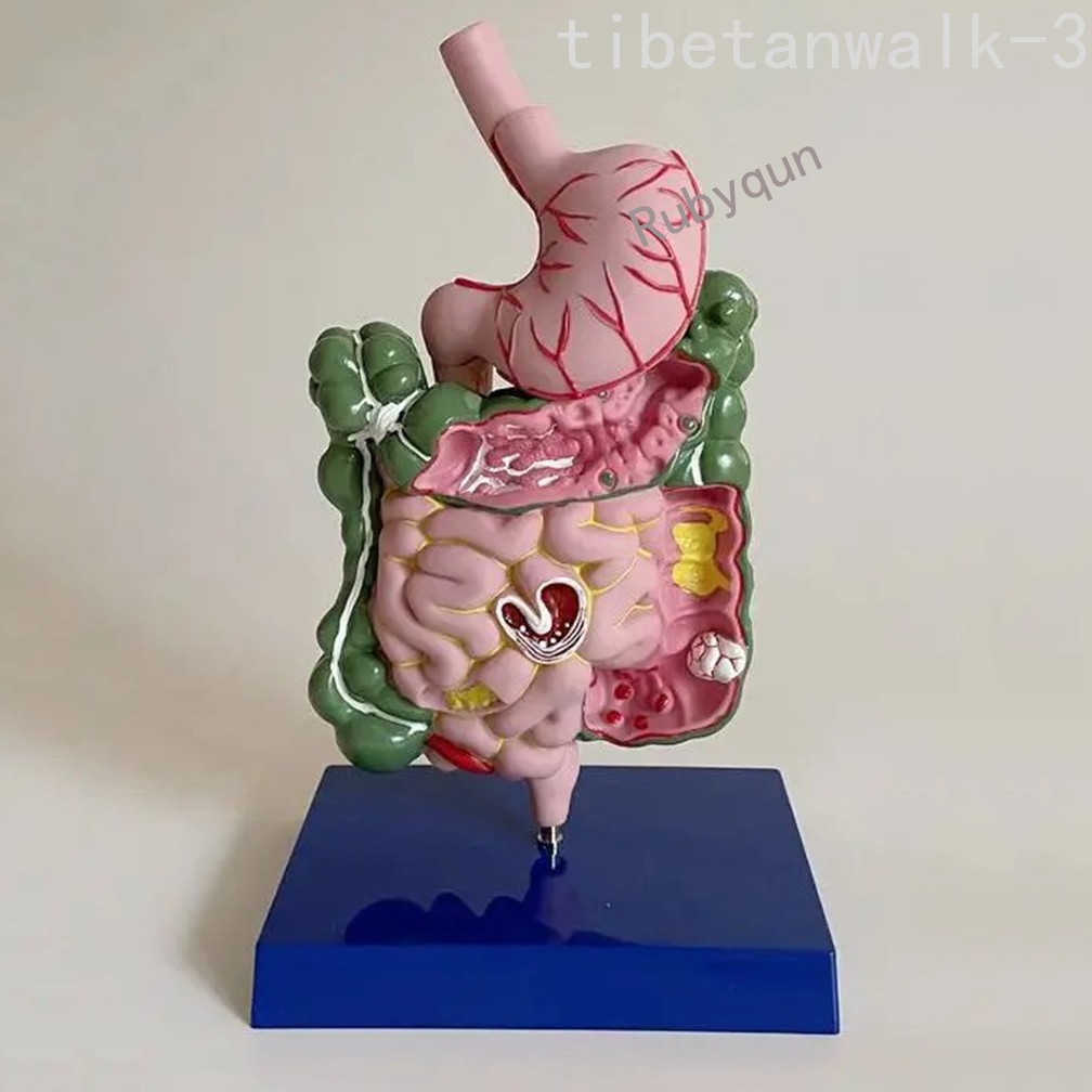 Human Digestive System Model Stomach Esophagus Stoh Large Small Intestine Ileum
