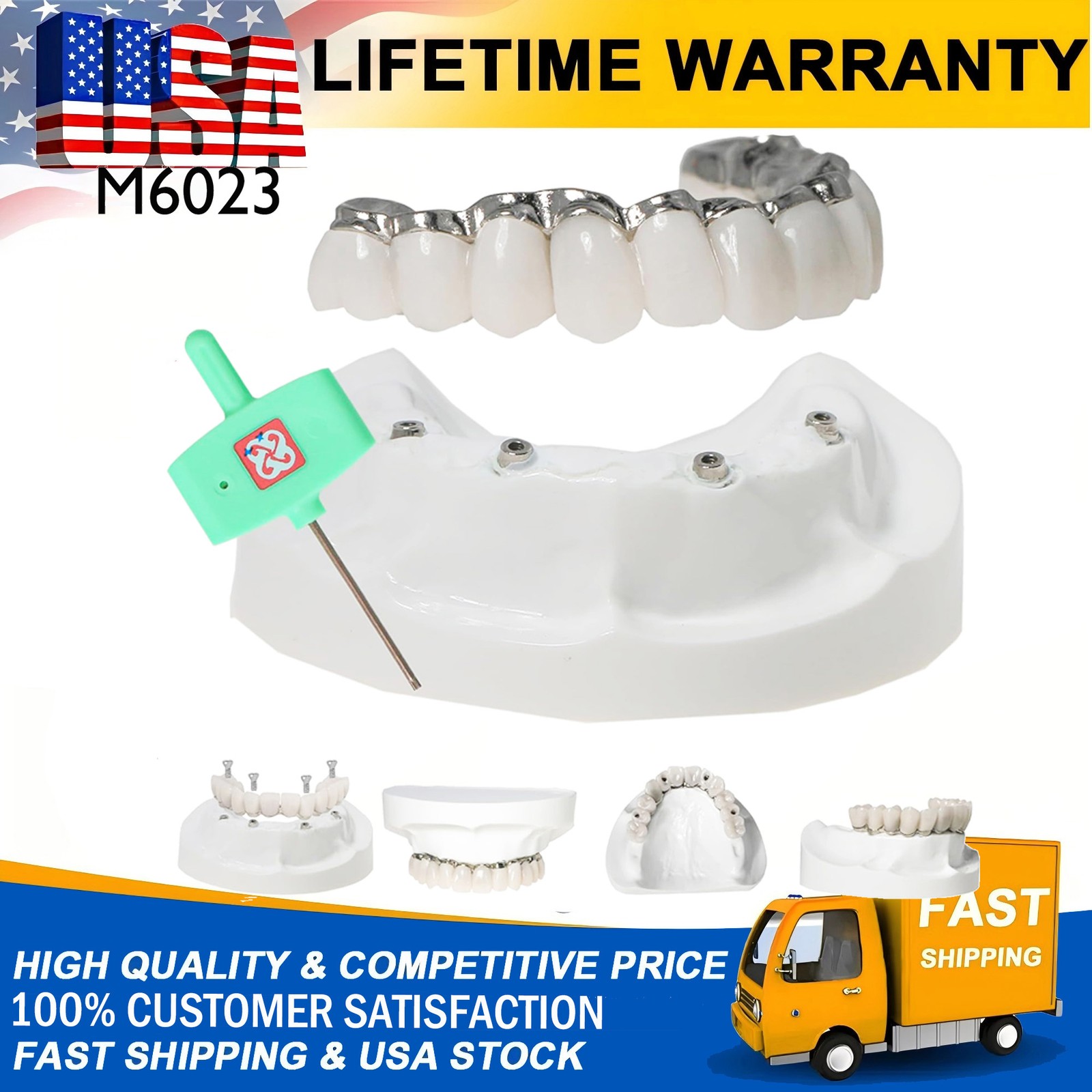 M6023 Dental All-on-4 Overdenture Model Upper Jaw Implants Restoration 4 Screws
