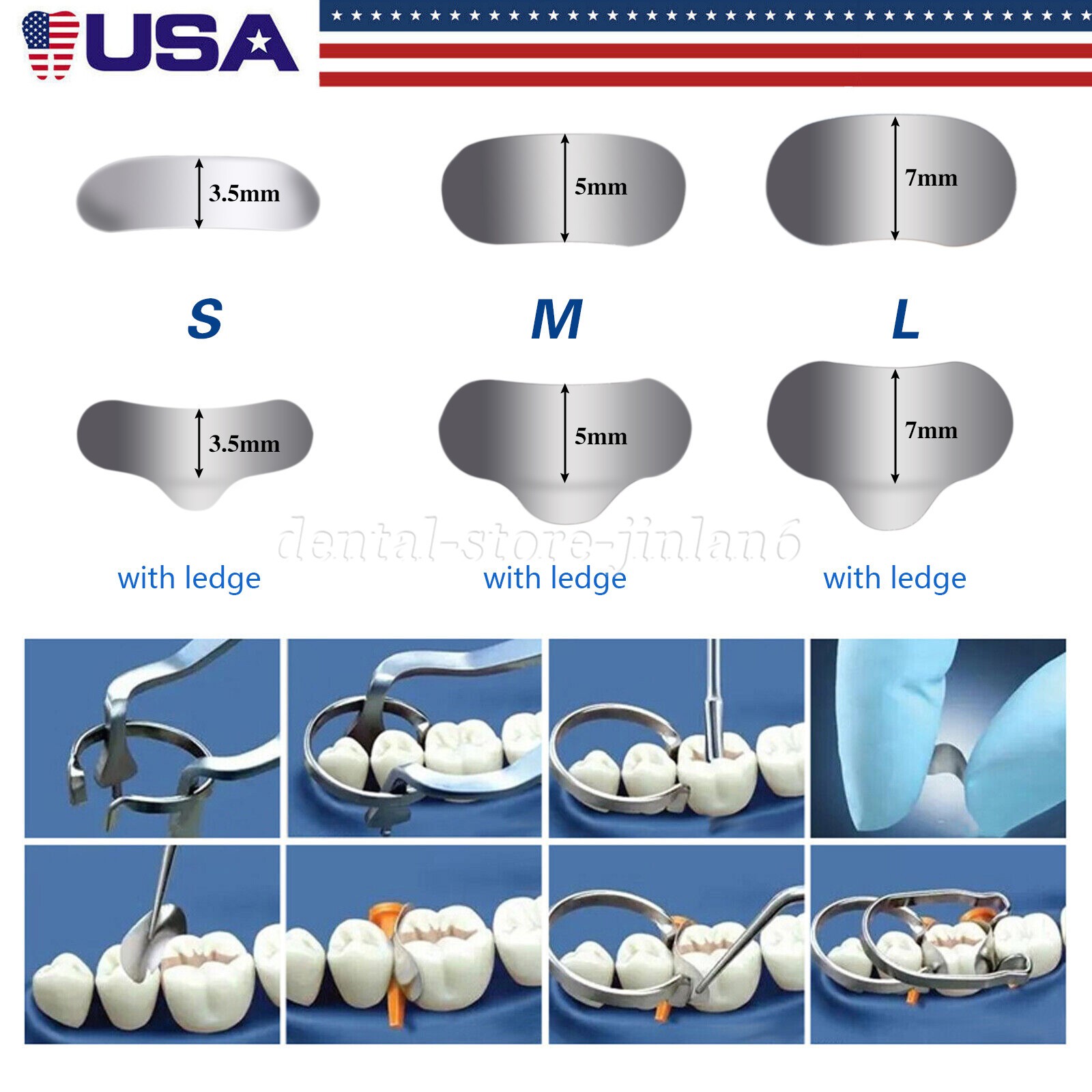 50 Pcs Dental Metal Matrices Matrix Band Sectional Contoured Refill S/M/L 35μm