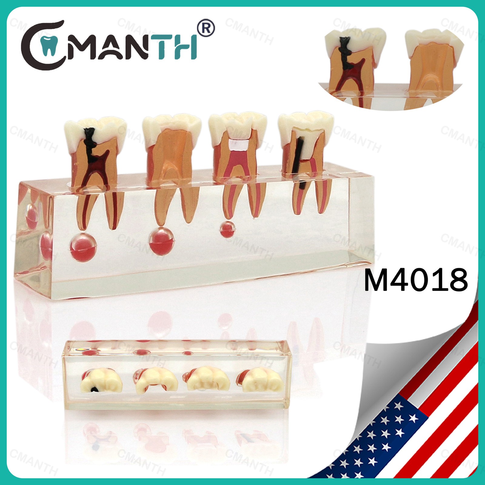 US Dental Teeth Model 4-Stage Molar Root Canal Caries Endodontic Treatment Study