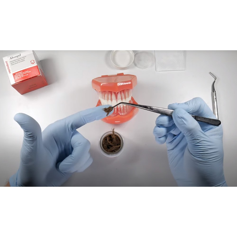 Septodont Alveogyl Paste 10g Post Extraction Dry Socket Alveolitis Treatment