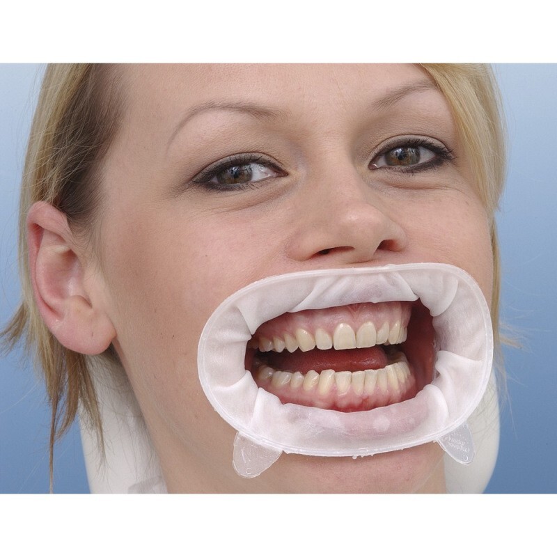 Ivoclar OptraGate Assortment Non Latex Optragate Lip Cheek Retractor 3 Types