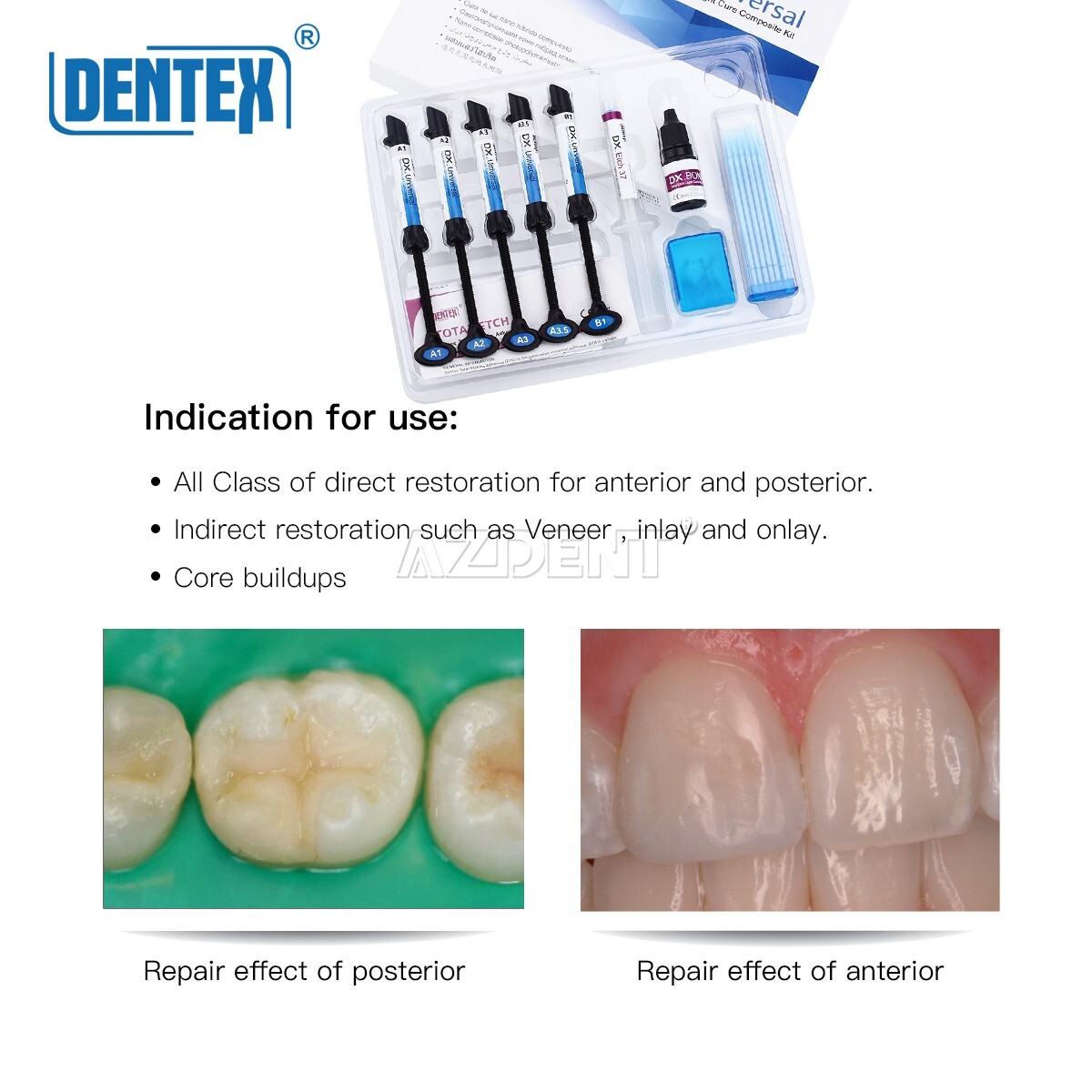Dental Universal Light Cure Composite Resin Kit Etching Gel A1 A2 A3 A3.5 B1