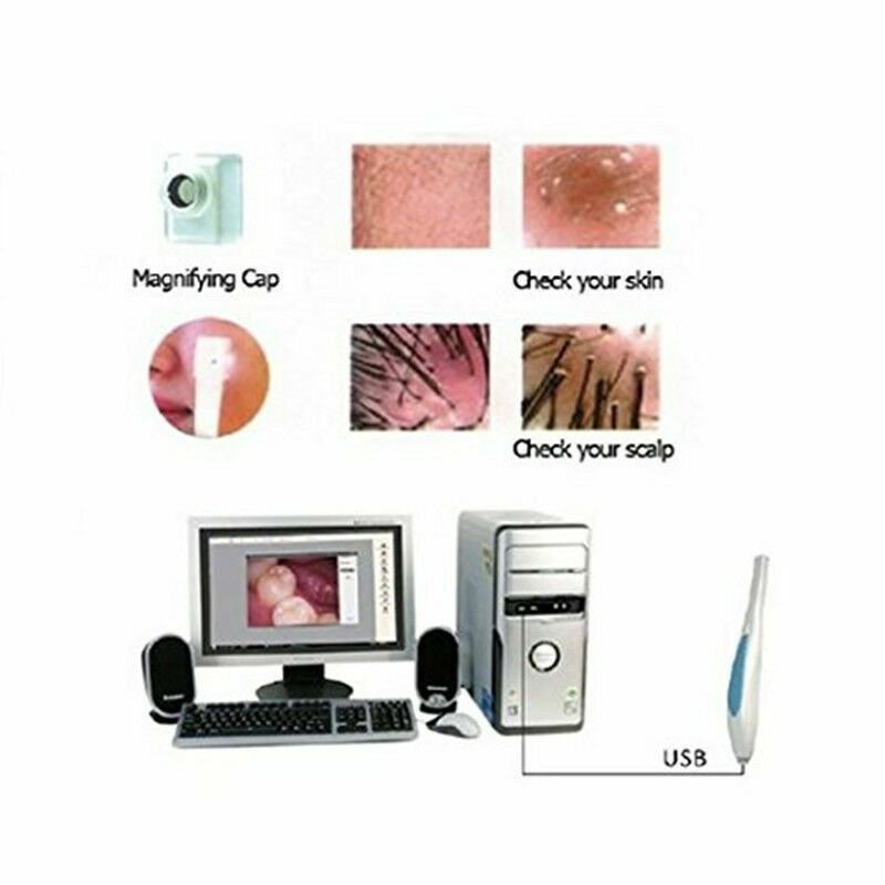Mini USB Dental Intraoral Camera MD770 1/4″CMOS 6Pcs LED Endoscope Home Use US