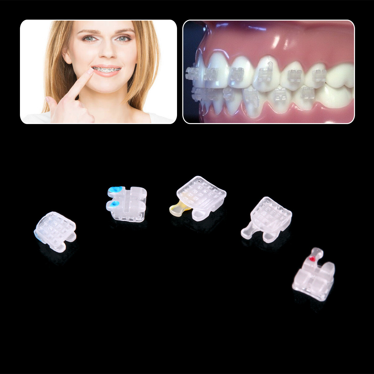 AZDENT Dental Orthodontic Ceramic Brackets Braces Roth.022 345 Hooks Marked
