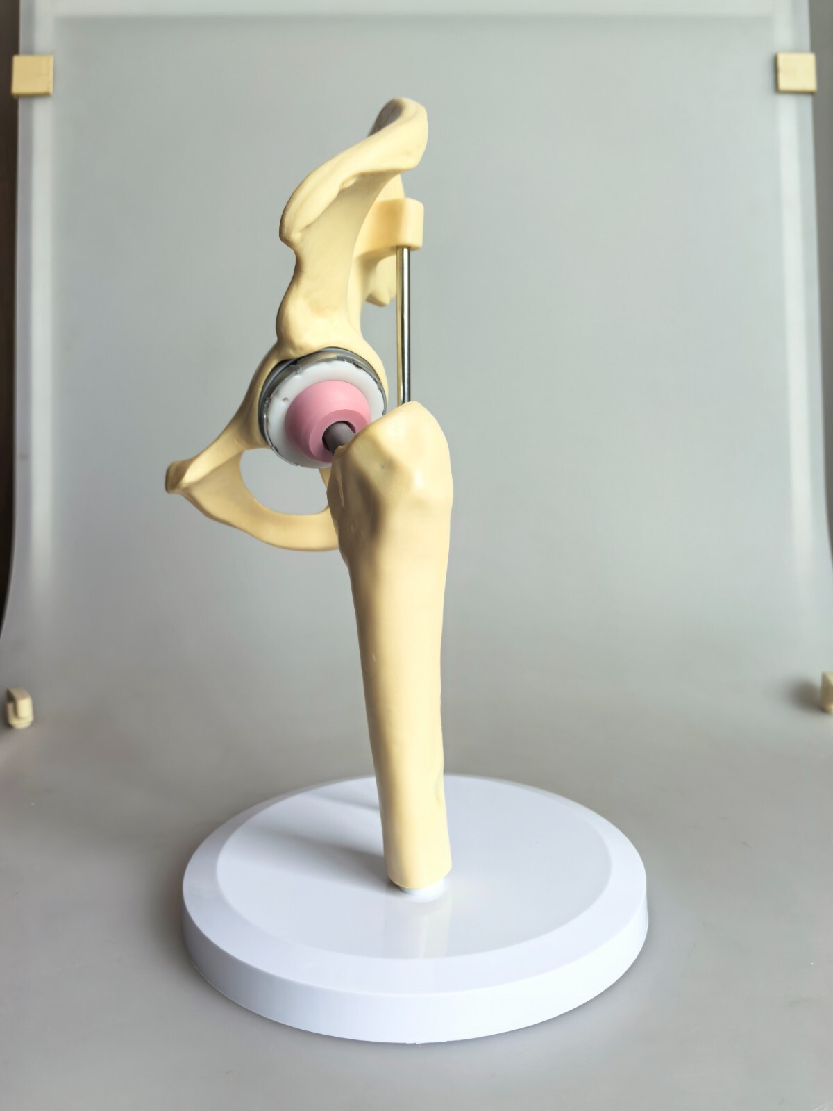 1:1 Artificial Hip Joint Replacement Medical Anatomical Skeleton Model Display