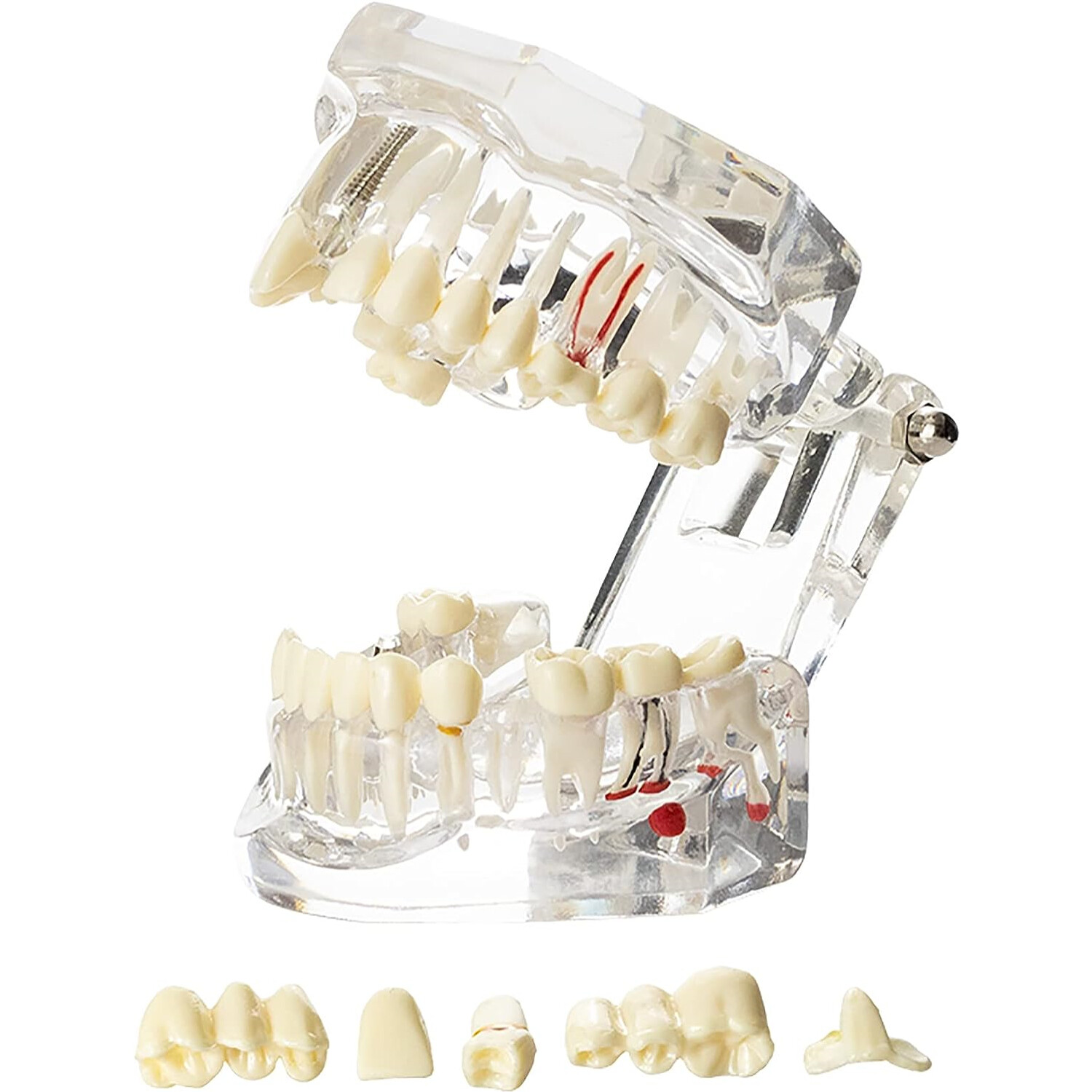 3D Teeth Model Dental Oral Typodont Model Ortho Implant Pathological Demo Model