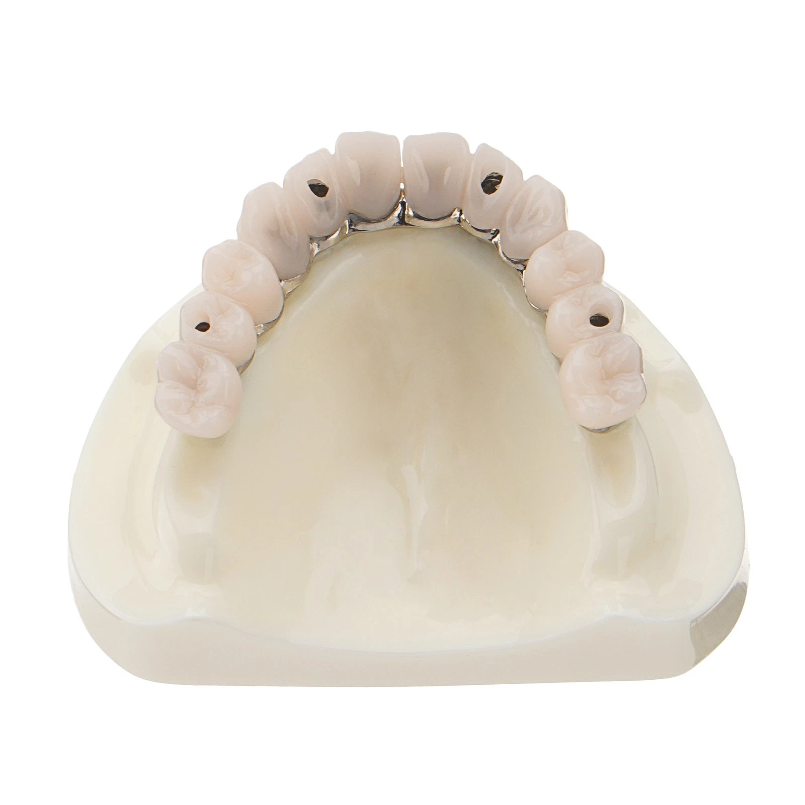 All-on-4 Dental Overdenture Model Dental Upper Jaw Implants Restoration 4 Screws
