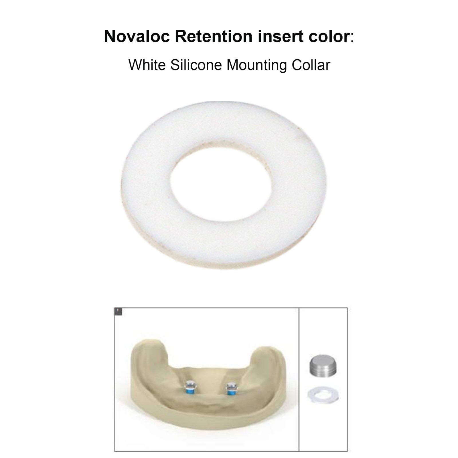 US Dental Novaloc Retention Inserts & Mounting/Demounting Tool Kit Overdenture