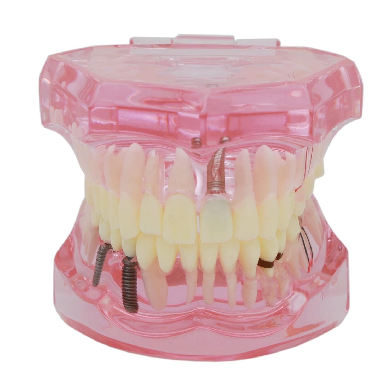 Dental Teeth Model Teach for Study Demo Restoration Pathology Bridge M2001 Pink