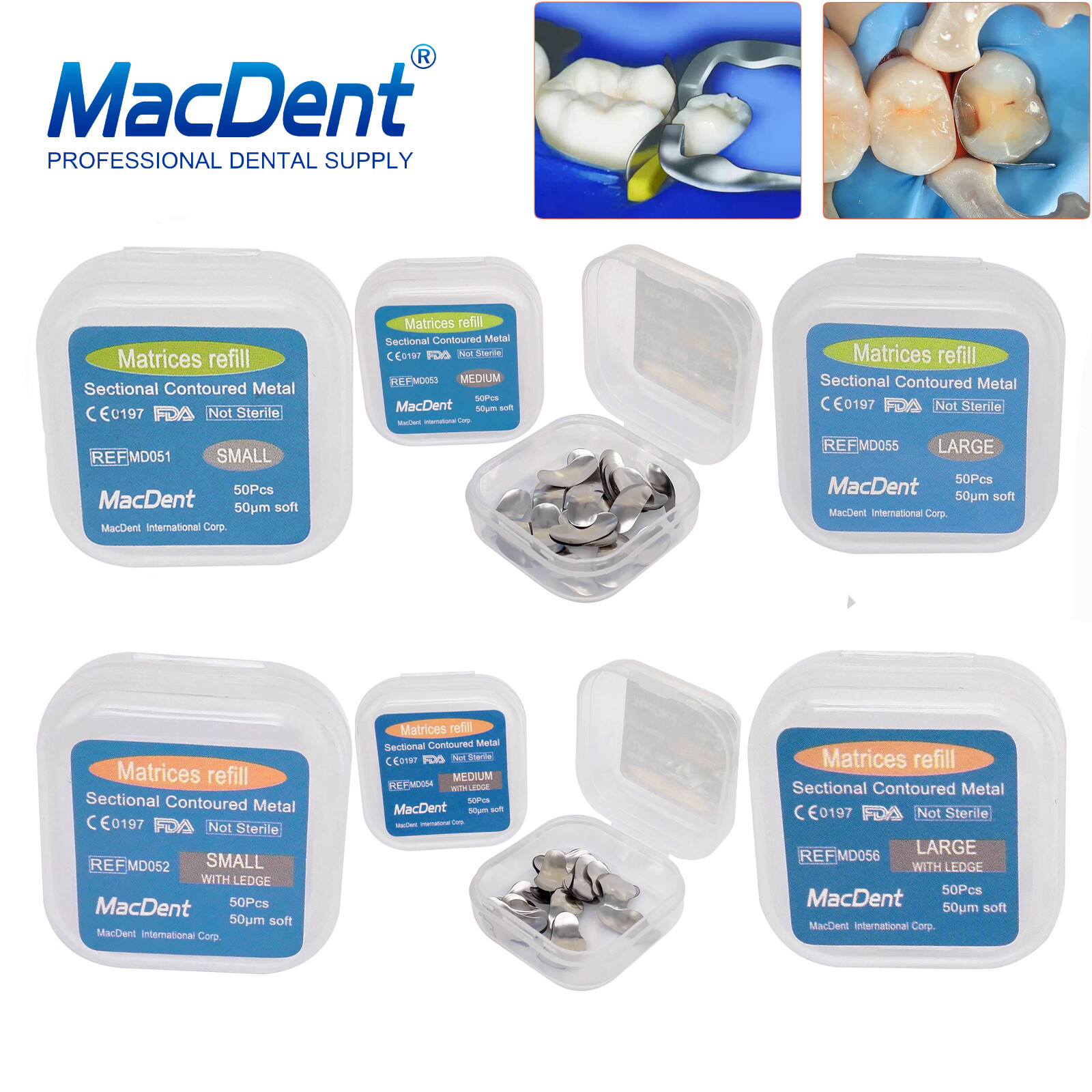 Dental Sectional Matrix System Contoured Metal Matrices Refill Matrix Bands 50x