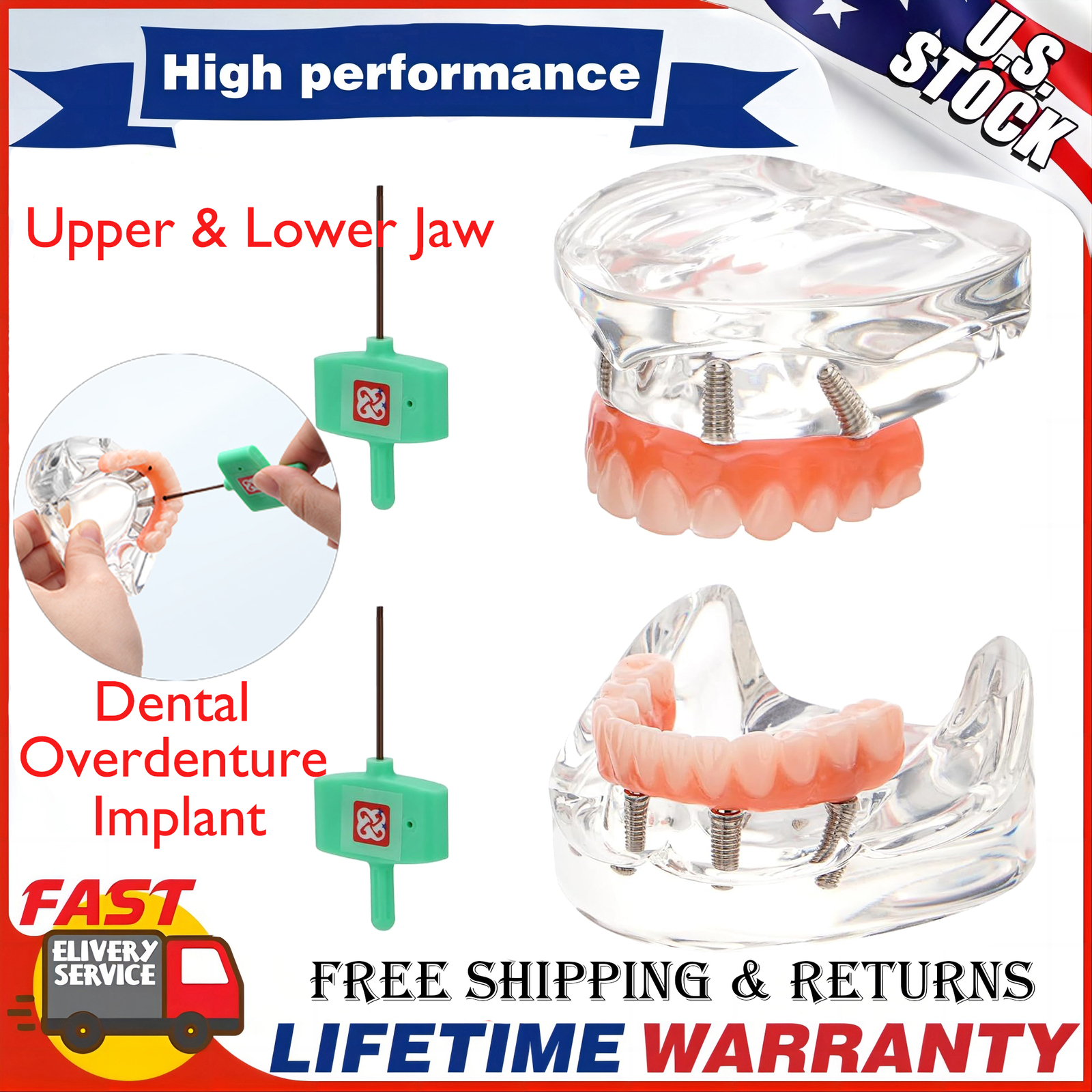 Dental Implant Typodont Teeth Restoration Model Overdenture Upper & Lower Jaw