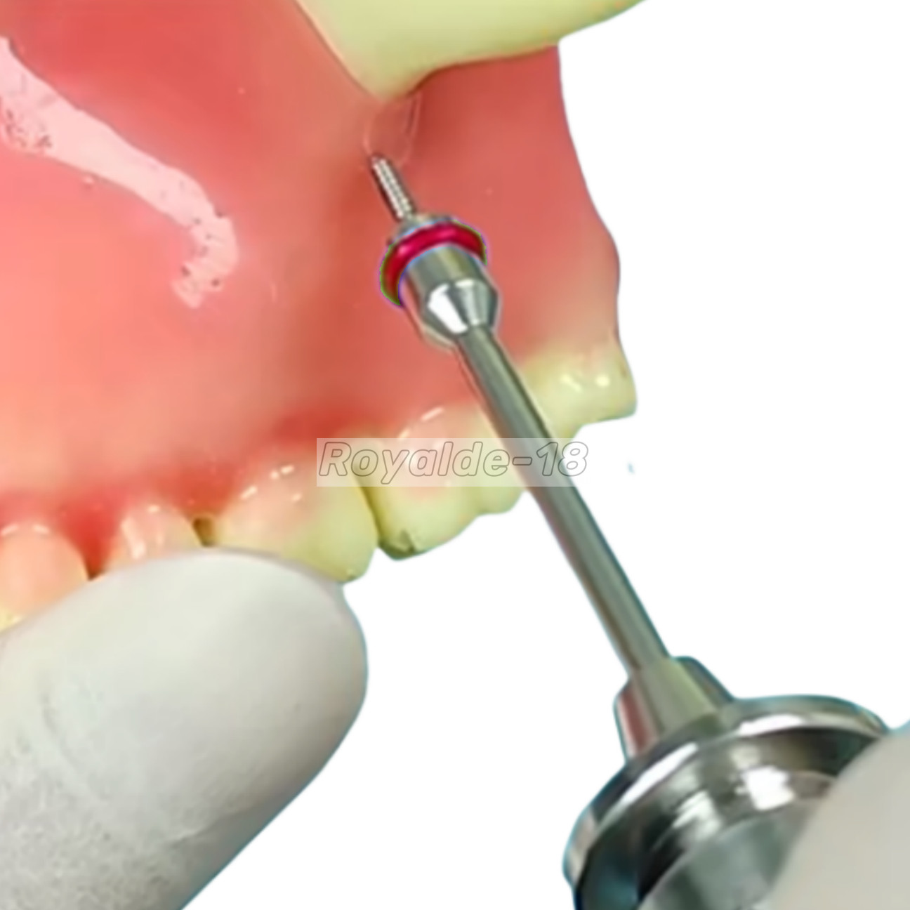 Dental Orthodontic Triangle Cap Mini Screw Micro Bone Titanium Screwdriver Rod