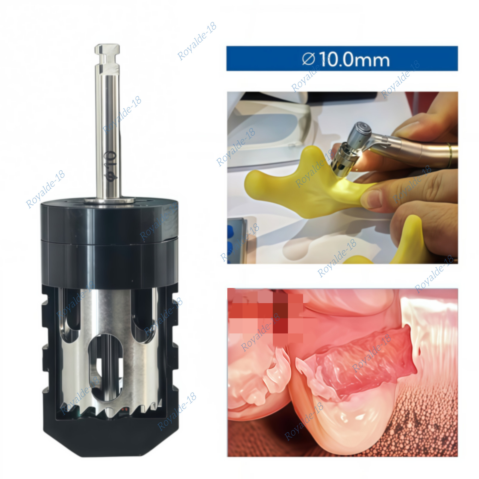 10.0MM Dental Half Moon B0ne Drill Sampling Trephine Bur Incremental B0ne Slice