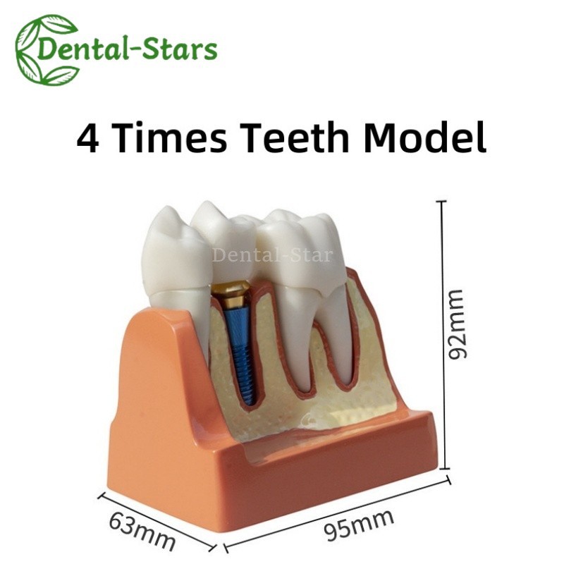 Dental Orthodontics Typodont Implant Analysis Crown Bridge Demonstration Model