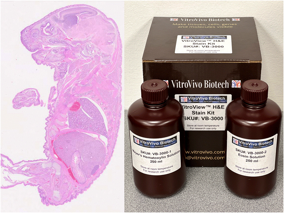 VitroView™ Hematoxylin and Eosin (HE) Stain Kit (250 ml/bottle) (CAT# VB-3000)