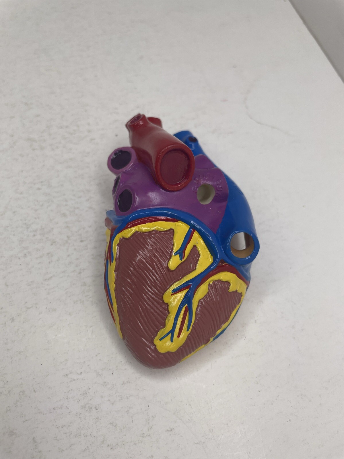 Diabetes Type 2 Anatomical Model GPI Patient Education Clinical 1996 Replacement