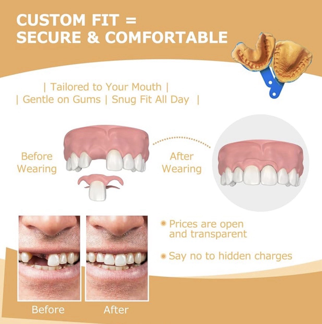 Initsmil Impression Kit 10 Pcs. Start Your Journey To A Perfect Smile