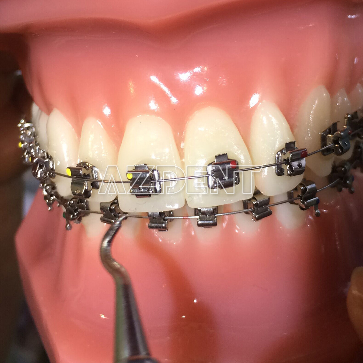 AZDENT Dental Ortho Brackets Brace Self-Ligating Active Mini Roth 022 Hooks 345