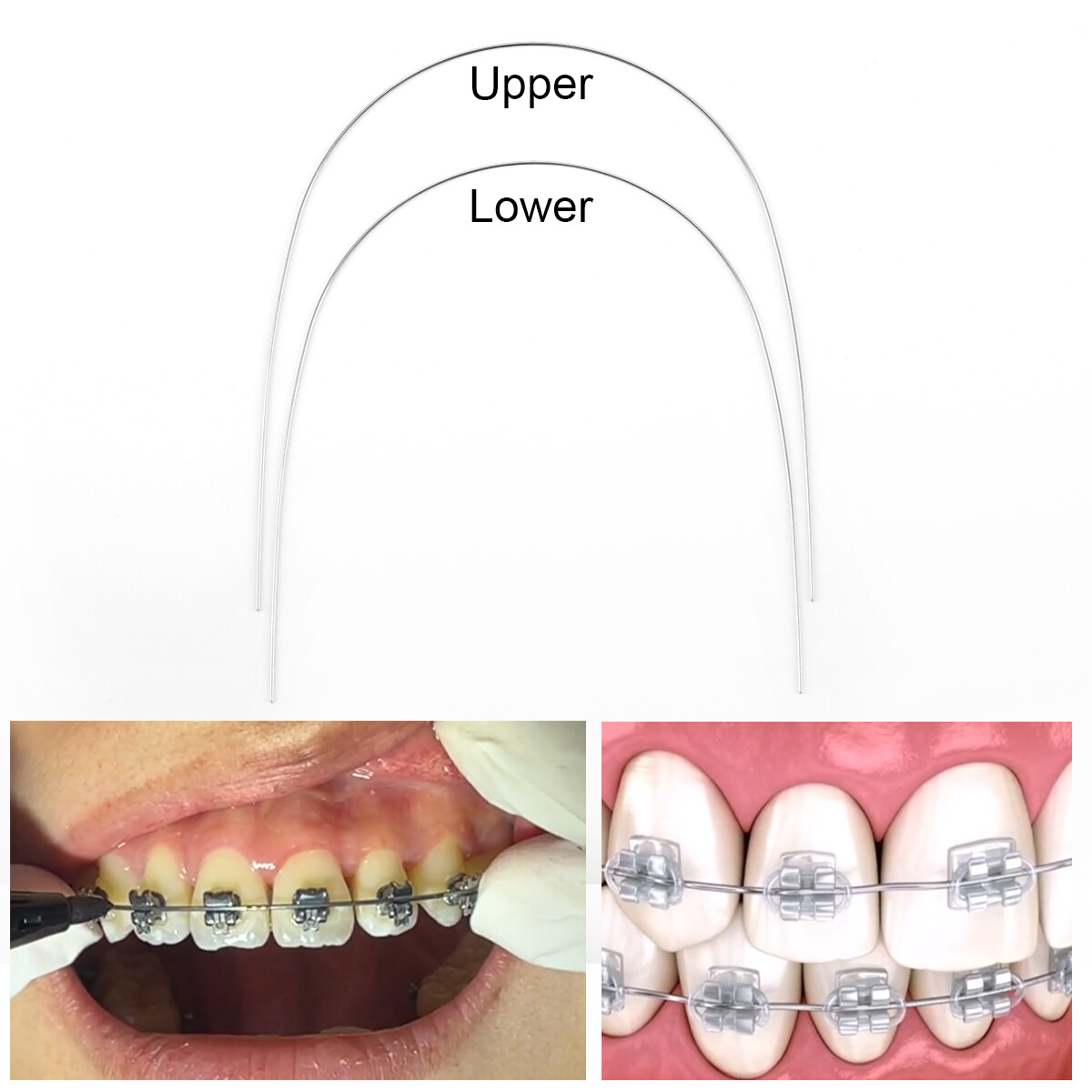 10pcs AZDENT Dental Orthodontic Super Elastic Niti Round Arch Wire Nature Form