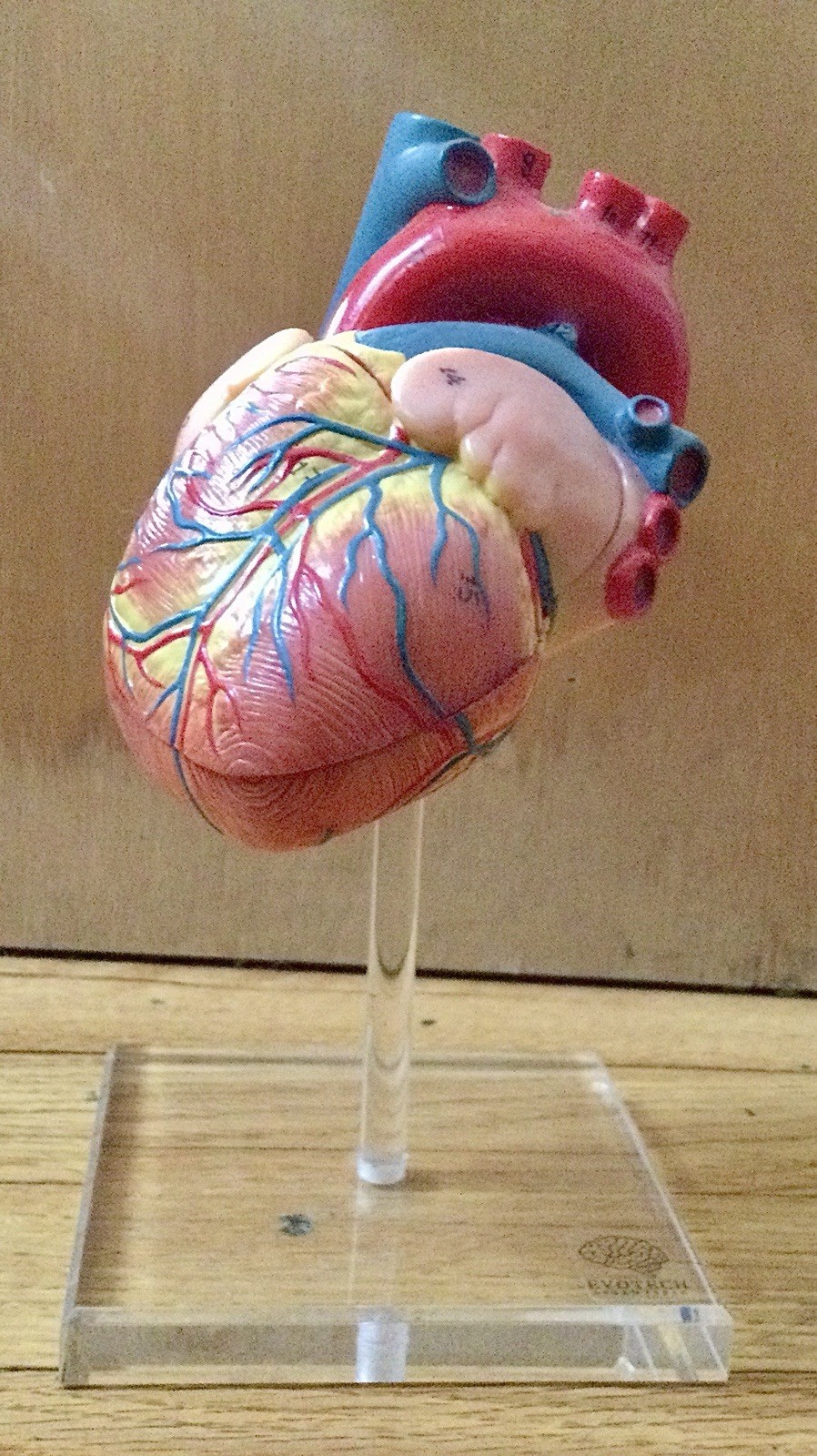 EVOTECH Scientific Anatomical Heart Model Dissectible Educational Display