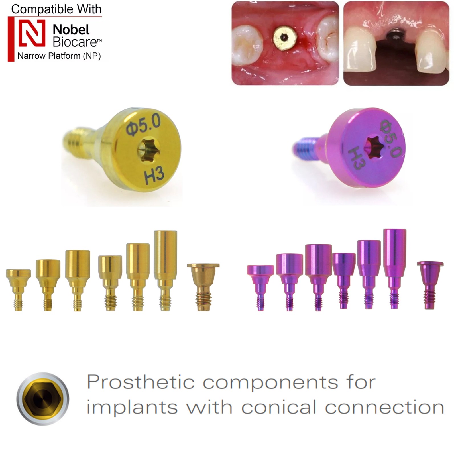 US Nobel Biocare Implant Healing Abutment Cap Titanium NP RP CC Temporary Dental