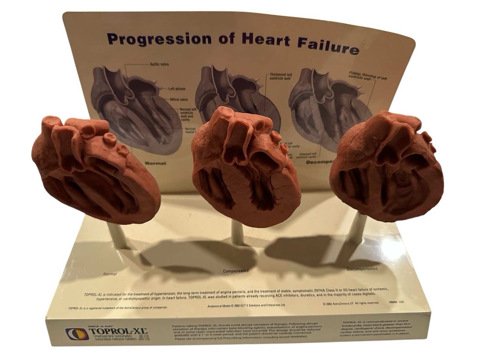 Human Progression Of Heart Failure Model Medical Teaching Educational Display