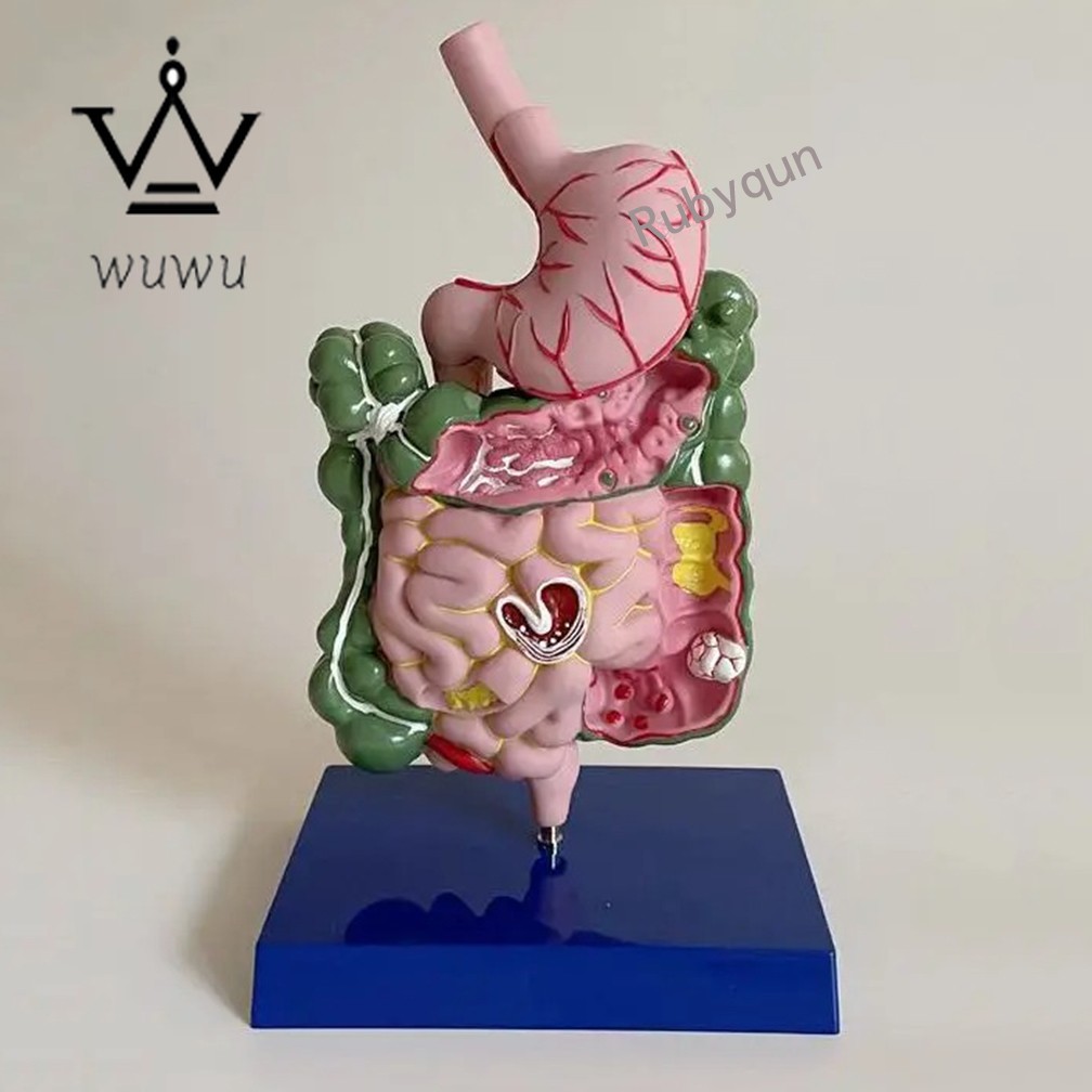 Human Digestive System Model Stomach Esophagus Stoh Large Small Intestine Ileum