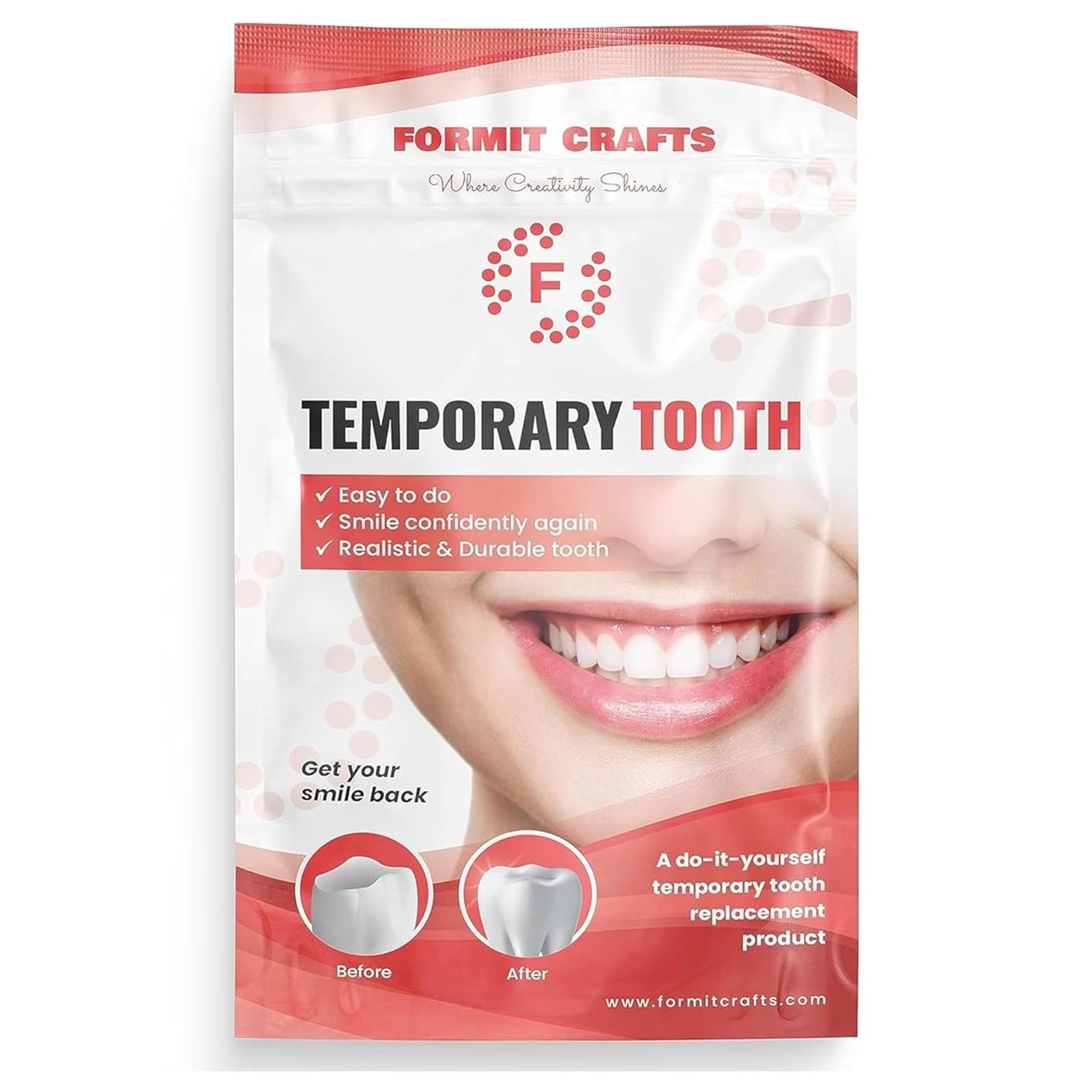 Thermoplastic Beads for Teeth Repair– DIY Tooth Filling – 20 Gram
