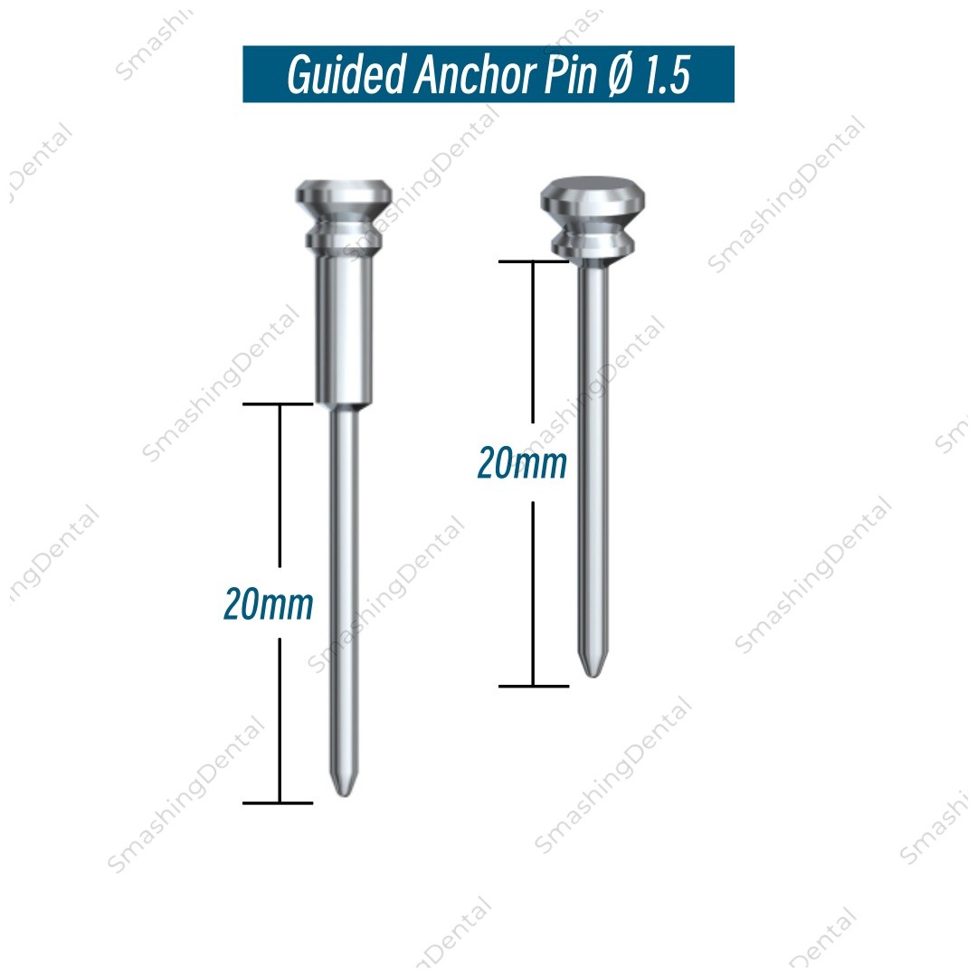 φ1.5 Dental Guided Anchor Pin Digital Guided Implant Fix Pins Guided Sleeves