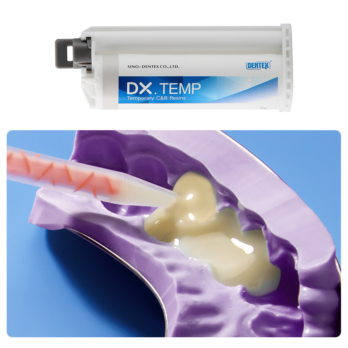 Dentex Dental Temporary Resin Material Blue/Crown Bridges Zinc Oxide Temp Cement